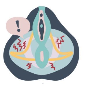 How Does Endometriosis Cause Painful Intercourse? - Pelvic